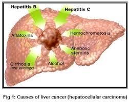 a hepatitis c súlycsökkenést okoz